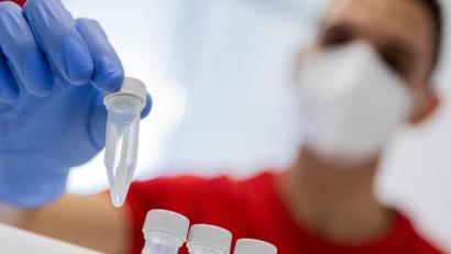 Bild: Rolf Vennenbernd/dpa
Künftig müssen Unternehmen in Deutschland ihren Mitarbeitern Corona-Tests anbieten. Das beschloss die Regierung am Dienstag.