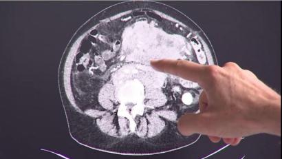 Bild: Klinikum/Dietl
Darmvorsorge ist auch zu Coronazeiten wichtig, betonen die Ärzte des Klinikums Amberg.