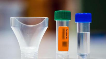 Bild: Nicolas Armer
Die Utensilien für einen Gurgeltest stehen auf einem Tisch.