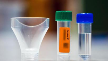 Symbolbild: Nicolas Armer/dpa
Die Utensilien für einen Gurgeltest stehen auf einem Tisch bereit.