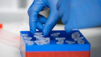 Archivbild: Christophe Gateau/dpa
Eine Laborantin sortiert im Institut für Virologie an der Charite Berlin Mitte, in dem Untersuchungen zum Coronavirus laufen, Proben.