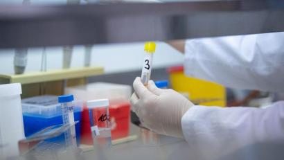 Symbolbild: Sebastian Gollnow/dpa
Eine Ärztin zeigt in einem Labor einen Test für das Coronavirus. Trotz einiger neu entdeckter Infektionen gehen die Inzidenzzahlen in Weiden und dem Landkreis Neustadt nach Angaben des Robert-Koch-Instituts nach unten.