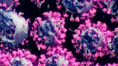 Bild: Peter Mindek/Nanographics/apa/dpa 
Eine Aufnahme von Forschern des TU Wien-Spin-off Nanographics zeigt Coronaviren.