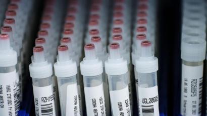 Symbolbild: Andreas Arnold/dpa
Tests auf Corona mag es auch in Weiden und im Landkreis Neustadt gegeben haben. Aber keiner war mit Blick auf die RKI-Zahlen am Donnerstag positiv.