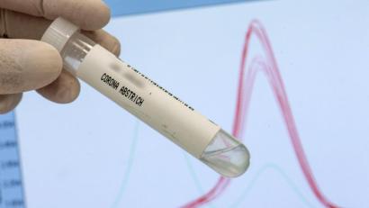 Symbolbild:  Boris Roessler/dpa
Zum ersten Mal wurde bei einem Infizierten aus dem Landkreis Tirschenreuth die Delta-Variante nachgewiesen.