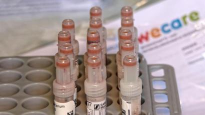 Archivbild: tr
Ein Bild von der ersten Testrunde vor einem Jahr in Tirschenreuth: In diesen Ampullen wurde das Blut für den Test aufbewahrt.