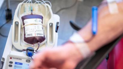 Bild: Marius Becker/dpa
Eine Blutkonserve wird während einer Spende gefüllt. Derzeit gibt es in Bayern zu wenige Blutspenden, was zu einem Mangel an Blutkonserven in den Krankenhäusern führt.