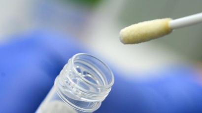 Symbolbild: Sebastian Gollnow
Ein Abstrich für das Testverfahren auf das Coronavirus.