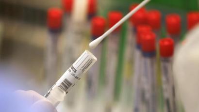 Symbolbild: Oliver Berg/dpa
In Weiden zeigen die Tests, dass die Zahlen der neu mit dem Coronavirus-Infizierten wieder steigen. Keinen neuen Coronafall gab es im Landkreis Neustadt.