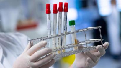 Symbolbild: Sven Hoppe
Sowohl in der Stadt Amberg als auch im Landkreis Amberg-Sulzbach gab es über das Wochenende neue Coronafälle.