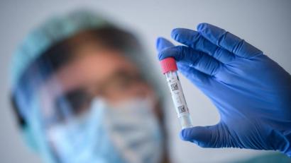 Symbolbild: Britta Pedersen/dpa
Im Landkreis Neustadt/WN galten laut 7-Tage-Statistik des Gesundheitsamts Neustadt-Weiden zwischen dem 17. und 23. August 28 von 38 Orten als coronafrei.