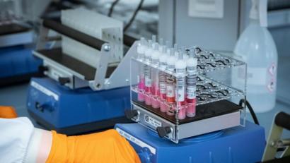 Symbolbild: Peter Steffen
Coronatests bei der Auswertung.