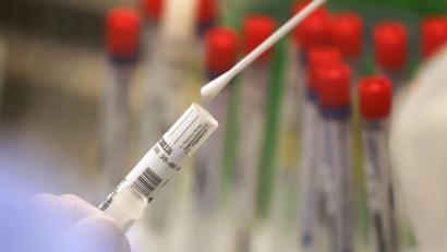 Symbolbild: Oliver Berg
Ein Abstrich wird in einem Labor auf das Coronavirus untersucht.