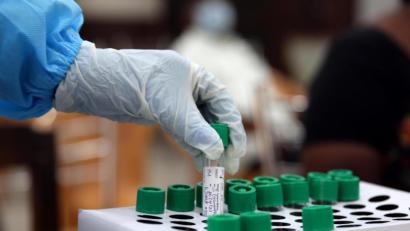 Symbolbild: Sri Loganathan/dpa
Bei den Lollitests lutscht jedes Kind an zwei Tupfern. Im Labor werden die Proben von allen gesammelt und als Pool untersucht.