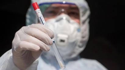 Symbolbild: Stefan Sauer/dpa
In Weiden und im Landkreis Neustadt/WN wurden zwischen Montag und Dienstag (8 Uhr) keine neuen Infektionen mit Covid-19 nachgewiesen.