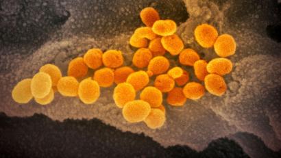 Symbolbild: NIAID-RML/AP/dpa
Eine elektronenmikroskopische Aufnahme des „U.S. National Institute of Health“ zeigt das Coronavirus (SARS-CoV-2).