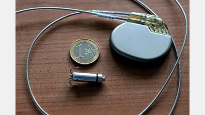 Bild: Stephan Huber
Ein konventioneller Herzschrittmacher mit Kabeln, ein Micra-Schrittmacher, der ungefähr die Größe einer Vitaminkapsel hat, und ein Ein-Euro-Stück zum Größenvergleich. In der Kardiologie am Klinikum St. Marien wurde heuer erstmals einem Patienten ein Exemplar des "kleinsten Schrittmachers der Welt" implantiert.