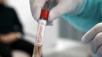 Bild: Salvatore Di Nolfi/KEYSTONE/dpa
Arzt, hat eine Probe einer Person, die im Verdacht steht, mit dem Coronavirus infiziert zu sein, in der Hand. In einem Amberger Pflegeheim haben sich mehrere Menschen infiziert.