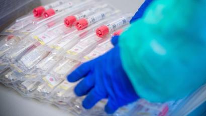 Symbolbild: Jens Büttner
Testsets mit Abstrichstäbchen liegen in einem Testzentrum für Corona-Verdachtsfälle.