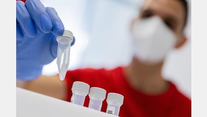 Archivbild: Rolf Vennenbernd/dpa
Ein Mitarbeiter stellt in einem Covid-19-Testzentrum einen Coronatest in ein Behältnis. Im Raum Amberg/Amberg-Sulzbach steigt die Gesamtzahl der positiven Testergebnisse weiterhin. Das Gesundheitsamt kann hier keine Entwarnung geben.