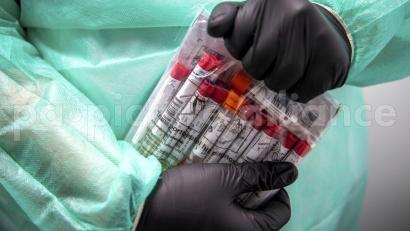 Symbolbild: Sina Schuldt/dpa
Proben für einen PCR-Test werden von einem Mitarbeiter im Corona-Testzentrum verpackt. Im Landkreis Tirschenreuth gab es am Donnerstag 14 positive Coronatests.