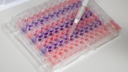 Bild: Christophe Gateau/szp
Übers Wochenende wurden im Landkreis Tirschenreuth 25 Personen positiv auf das Coronavirus getestet.