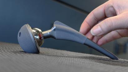 Symbolbild: Felix Kästle/exb
Medizinische Implantate – hier im Bild ein künstliches Hüftgelenk – sind seit vergangenem Mai auch in Lindenlohe schwerer zu bekommen.