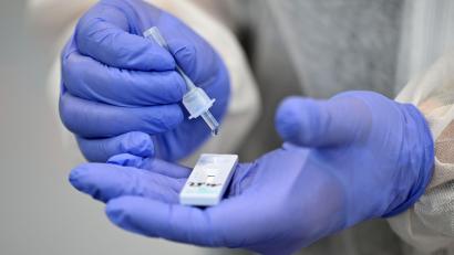 Symbolbild: Martin Schutt / dpa
253 Mal bestätigten Tests auf das Coronavirus von Dienstag auf Mittwoch in Weiden und dem Landkreis Neustadt/WN neue Coronafälle.