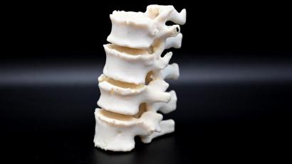Bild: cf
Bei BAM entstehen im 3D-Drucker medizinische Modelle