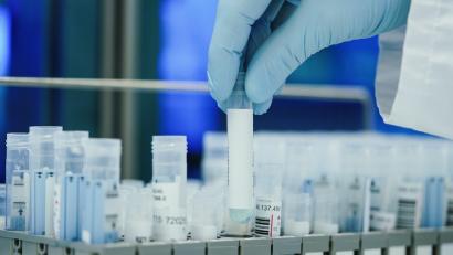Symbolbild: Uwe Anspach/dpa
Ein Mitarbeiter hält in einem Coronatest-Labor PCR-Teströhrchen in den Händen. Innerhalb einer Woche gab es im Landkreis Tirschenreuth 1020 positive Coronatests.