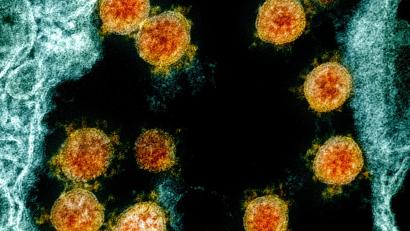 Bild: Uncredited/NIAID/NIH/dpa
Eine elektronenmikroskopische Aufnahme zeigt Partikel des Coronavirus SARS-CoV-2..