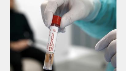 Symbolbild: Salvatore Di Nolfi
Die Zahl der positiven Proben auf das Coronavirus ist in Weiden und dem Landkreis Neustadt/WN weiterhin hoch.