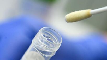 Bild: Sebastian Gollnow/dpa/Symbolbild
Ein Abstrich für das Testverfahren auf das Coronavirus.