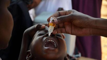 Bild: Nicholas Kajoba/XinHua/dpa
Ein Kind erhält einen Impfstoff gegen Polio.