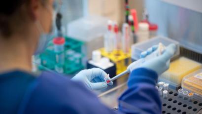 Bild: Daniel Reinhardt/dpa
Bei der aktuell hohen Positivrate bei PCR-Tests muss auch von einer hohen Dunkelziffer ausgegangen werden.