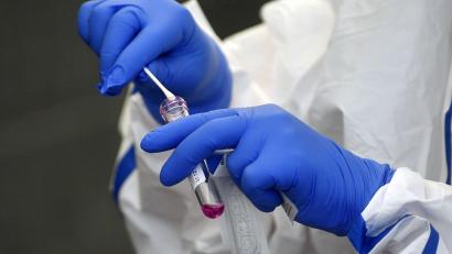 Symbolbild: exb/Hendrik Schmidt
Die Tests bringen es ans Licht, dass sich stetig weitere Menschen mit dem Coronavirus infizieren.