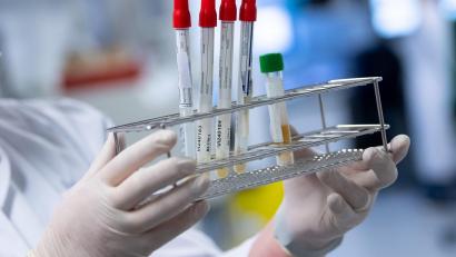 Symbolbild: Sven Hoppe/dpa
Eine Laborantin bereitet Proben für Corona-Tests für die weitere Analyse vor.