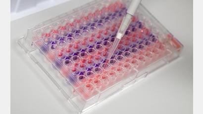 Bild: Christophe Gateau
In der Region Amberg-Sulzbach steigt die Sieben-Tage-Inzidenz. Am Mittwoch kamen 599 neue Infizierte hinzu.