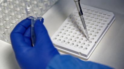 Symbolbild: Henning Kaiser/dpa
Eine Mitarbeiterin eines Labors füllt mit einer Pipette eine Testflüssigkeit in einer Trägerplatte.