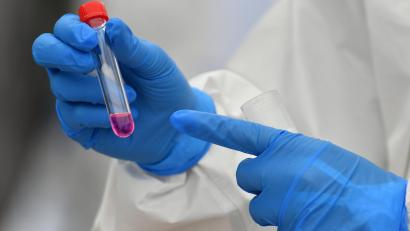 Symbolbild: Hendrik Schmidt/dpa
Eine Laborantin hält einen Corona-Test in der Hand.