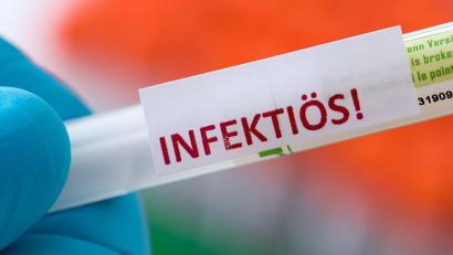 Symbolbild: Hendrik Schmidt/dpa
Eine Probe für einen Corona-Test in einem Diagnostik-Labor.