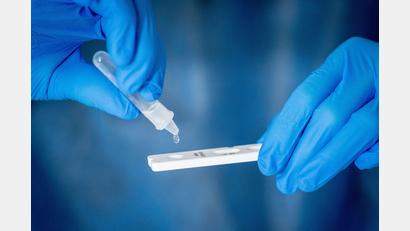 Symbolbild: dpa/Kay Nietfeld
Corona-Tests funktionieren auch am Wochenende – nur die Übermittlung nicht mehr.