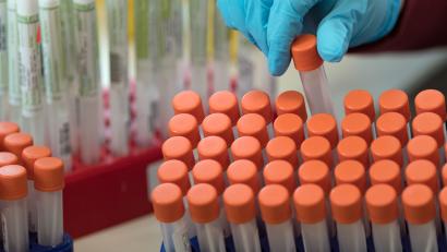 Bild: Hendrik Schmidt
Proben für Corona-Tests werden im Labor für die weitere Untersuchung vorbereitet.