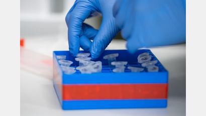 Symbolbild: Christophe Gateau
55 058 Corona-Fälle sind inzwischen aus dem Landkreis Schwandorf registriert.
