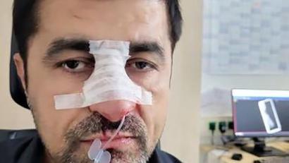 Bild: Arif Tasdelen/dpa
Das vom Landtagsabgeordneten Arif Tasdelen, Bruder von Halil Tasdelen, zur Verfügung gestellte Bild zeigt den verletzten Halil Tasdelen.