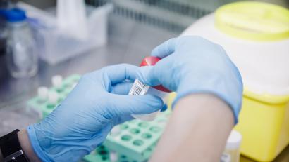 Symbolbild: Carlos Luján/dpa
Eine Krankenschwester untersucht einen PCR-Test. Der erste Fall von Affenpocken in der Oberpfalz ist bekannt und erwiesen.