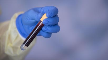 Symbolbild: Marijan Murat/dpa
Wegen einer Trunkenheitsfahrt brachte die Polizei einen 56-Jährigen ins Krankenhaus zur Blutentnahme. Kurze Zeit später wollte der Mann die Blutprobe im Auto stehlen.