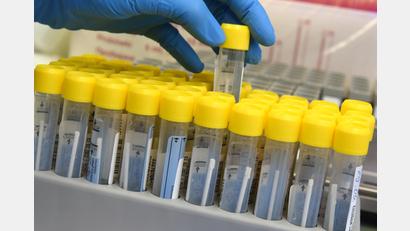 Symbolbild: Waltraud Grubitzsch/dpa
Im Landkreis Tirschenreuth gab es innerhalb einer Woche 306 positive Coronatests.