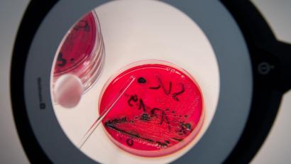 Bild: Arno Burgi/dpa-Zentralbild/dpa
Nachgewiesene Salmonellen in einer Petrischale.