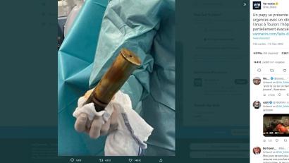 Screenshot: Var-Matin
Die französische Zeitung "Var Matin" veröffentlichte ein Foto des Fremdkörpers auf Twitter, nachdem es aus dem Gesäß entfernt worden ist.